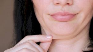 Gıdı problemine doğal çözüm