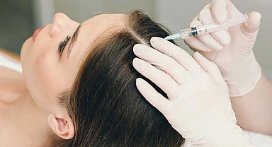 Saç dökülmesine mucizevi yöntem: Mezoterapi