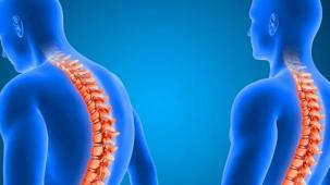 Omurga tümörünün tipi tedaviyi belirliyor!