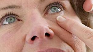 Göz kapağı hastalıklarına dikkat!