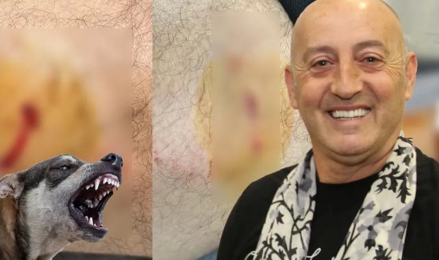 Gemlik Karacaali Muhtarı'na sokak köpeklerinden saldırı!