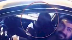 Jandarma'dan hayat kurtaran müdahale! Takma dişini yutan vatandaş kurtarıldı