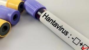 Hantavirüs salgına dönüşür mü? Kapalı alan temizliğinde büyük risk